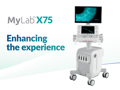 Mylab X75